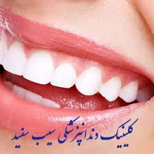 آیا کامپوزیت دندان و لمینت درد دارند؟