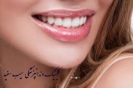 composite-or-porcelain-?