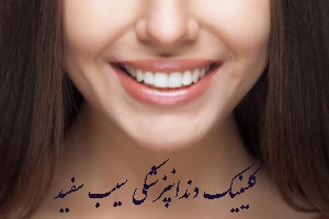 composite-veneer-or-tooth-lamianation-which-one-is-better