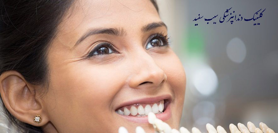 difference-between-composite-tooth-lamination-and-crowns