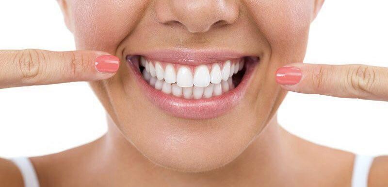 سوالات رایج بلیچینگ دندان