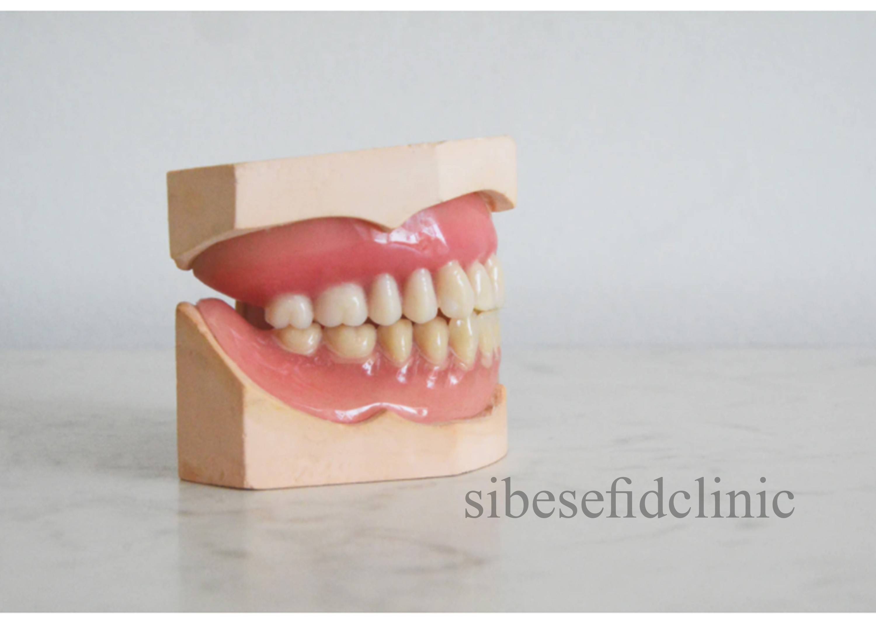 آیا درمان لمینت بهتر از کامپوزیت ونیر است؟