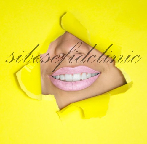 ماندگاری لمینت دندان