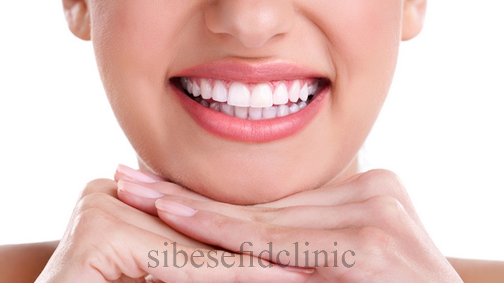 نكته هایی درباره كامپوزيت كه معمولا دندانپزشكان به شما نمي گويند