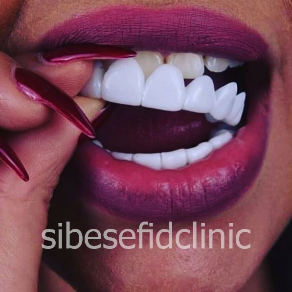 اسنپ آن اسمایل چیست؟