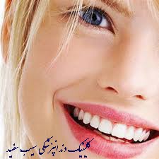 آیا کامپوزیت دندان ایمن هست