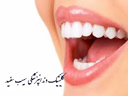 composite-baraye-dandanhaye-shekaste