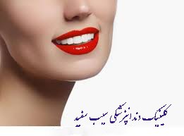 کامپوزیت دندان برای دندان های کج