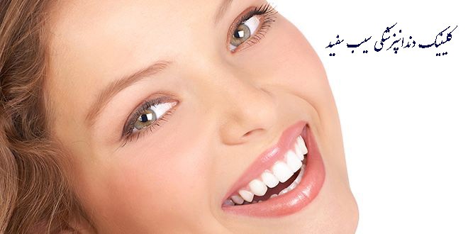 مراحل انجام کامپوزیت دندان