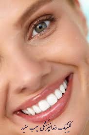 کامپوزیت دندان،نظرات بیماران:بهترین دکتر و بهترین کامپوزیت،مزایاو معایب