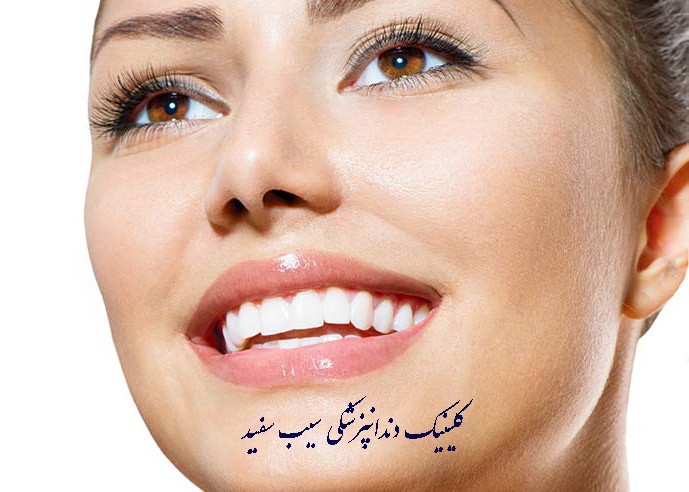 composite-veneer-procedures