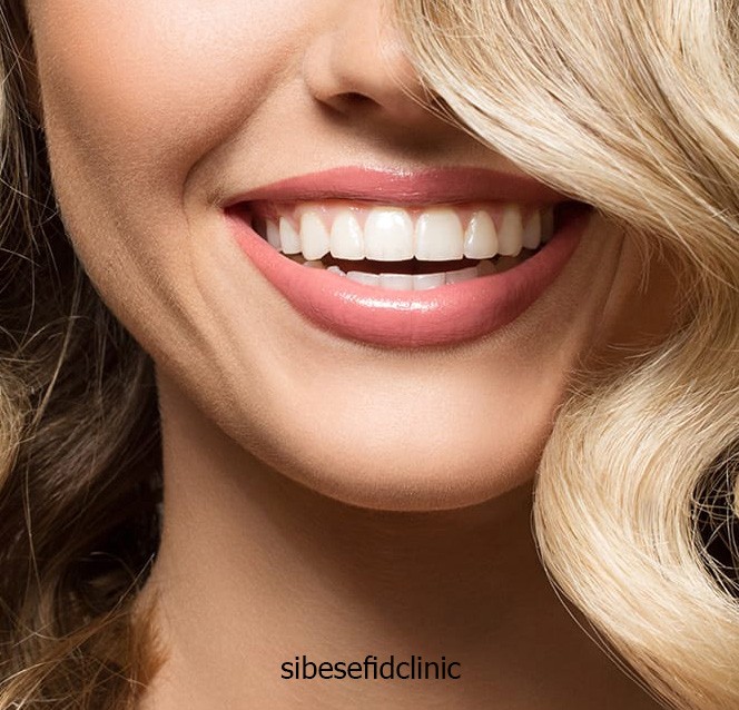 آیا می توان دندان روکش شده را کامپوزیت کرد؟