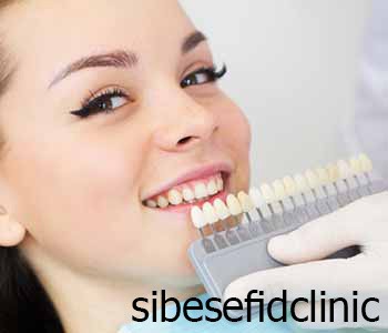 ضخامت لمینت دندان