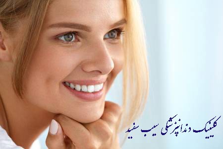 طول عمر لمینت دندان