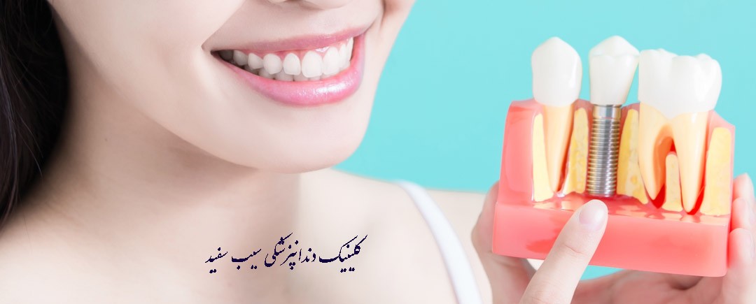 che-kasani-mitavanand-dandanhayeshan-ra-implant-konand