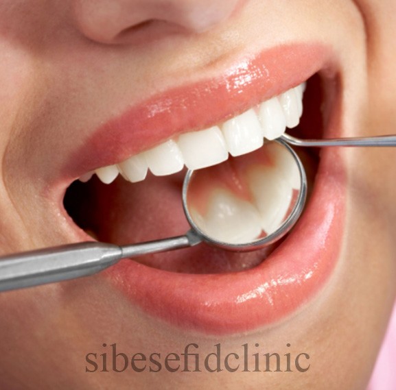 رنگ دندان چقدر سفيد باشد بهتر است؟