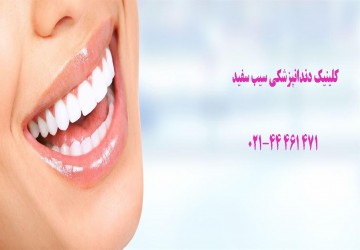 نکات مهم درمورد سفید کردن دندان‌ها