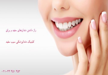 چگونه دندان‌های سفیدی داشته باشیم؟راز داشتن دندان‌های سفید و روشن