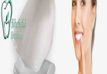 چگونه بهترین کامپوزیت دندان مناسب صورت خود را انتخاب کنید