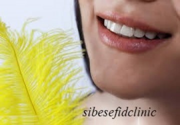 لمینت دندان ناموفق