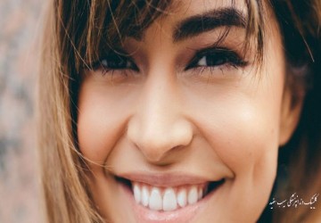 آیا لمینت دندان عوارض دارد؟