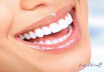 آیا لمینت دندان دائمی است