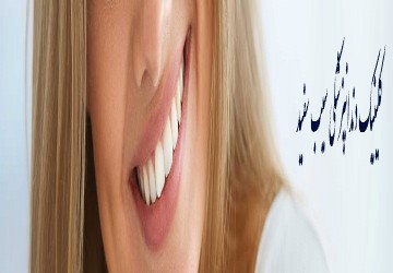 طول عمر ایمپلنت دندان