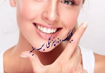چه زمانی باید لمینت دندان را تعویض کنید