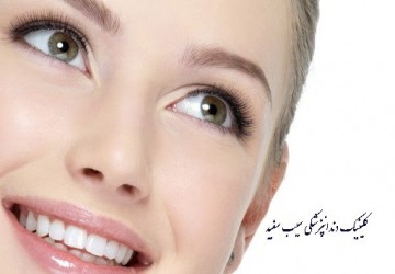 مراحل انجام لمینت دندان