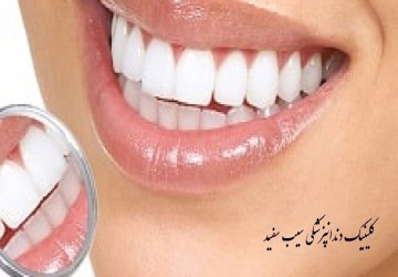 آیا دندان های فک پایین نیز باید کامپوزیت شوند