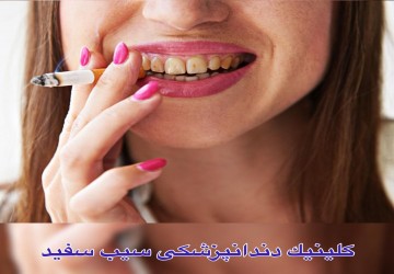 آماری تجربی از تاثیر سیگار بر لمینت یا کامپوزیت دندان