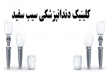 آیا ایمپلنت دندان دائمی است؟