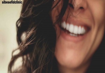 آیا لمینت نیاز به تراش دارد؟