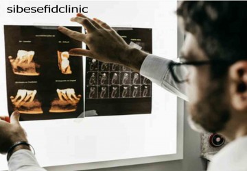 برندهای مختلف ایمپلنت