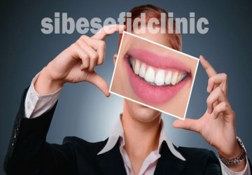 چه کسانی کاندید لمینت دندان هستند؟