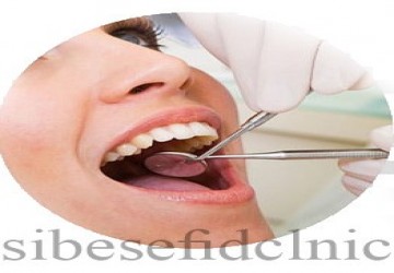 هزینه ایمپلنت کل دندان ها