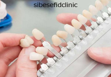 بستن فاصله بین دندانی