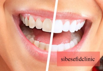 طبیعی یا مصنوعی بودن کامپوزیت ونیر به چه عواملی بستگی دارد؟