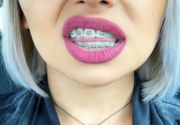 آیا ارتودنسی یک فک امکان پذیر است؟