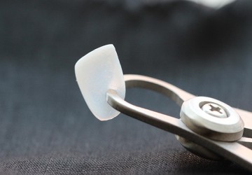 جایگزینی کامپوزیت با لمینت