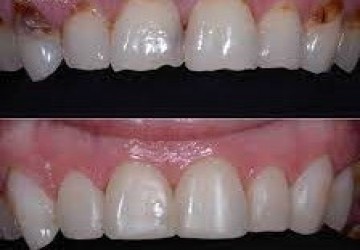 علت تفاوت قیمت در لمینت و کامپوزیت