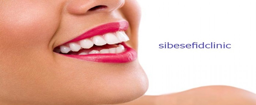 چگونه لبخندی زیبا داشته باشیم؟ قوانین داشتن لبخند زیبا و جذاب