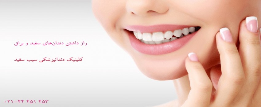 چگونه دندان‌های سفیدی داشته باشیم؟راز داشتن دندان‌های سفید و روشن