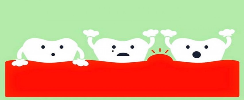 بازسازی بافت لثه و جلوگیری از، از دست دادن دندان