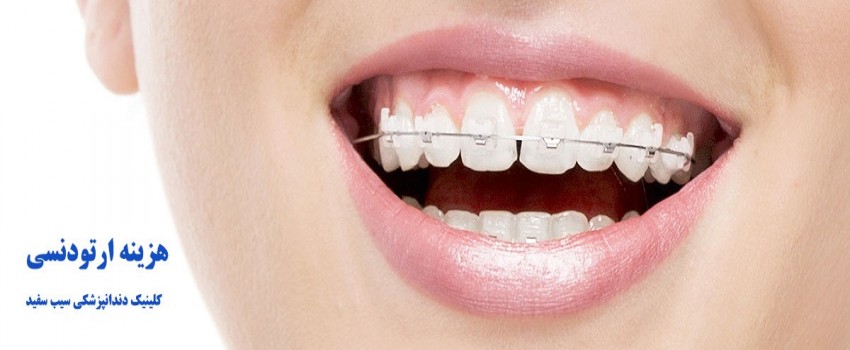 هزینه ارتودنسی دندان