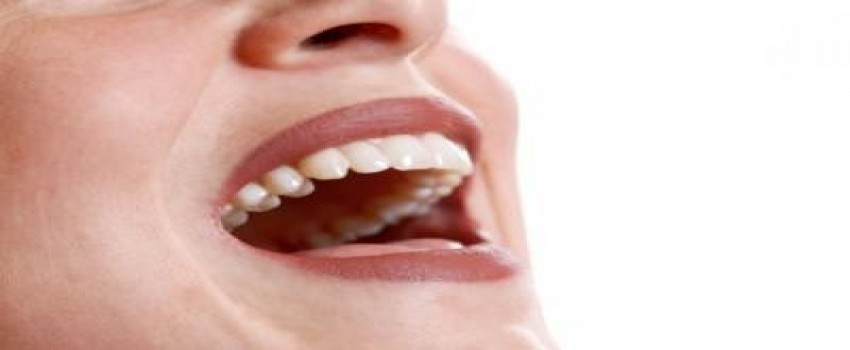 بهترین شکل نگهداری از ونیرهای دندان