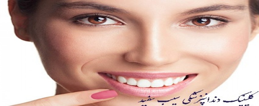 کامپوزیت ونیر مستقیم چیست؟