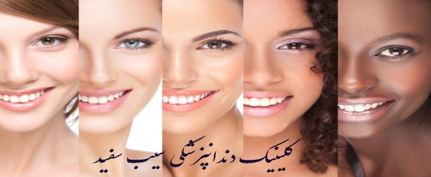 کامپوزیت بهتر است یا لمینت