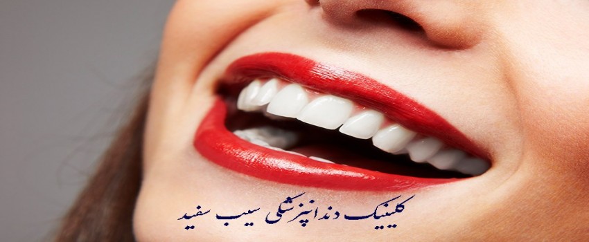 مراقبت از کامپوزیت دندان