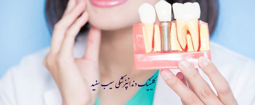 آیا ایمپلنت دندان ایمن هست